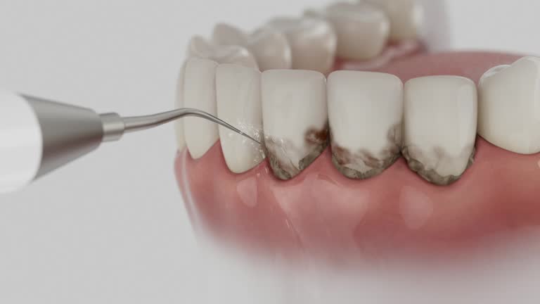 Reliable Dental Implants contractor in Pine Mountain Club, CA by Smile Center Dentistry
